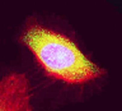 EBP1 Antibody in Immunocytochemistry (ICC/IF)