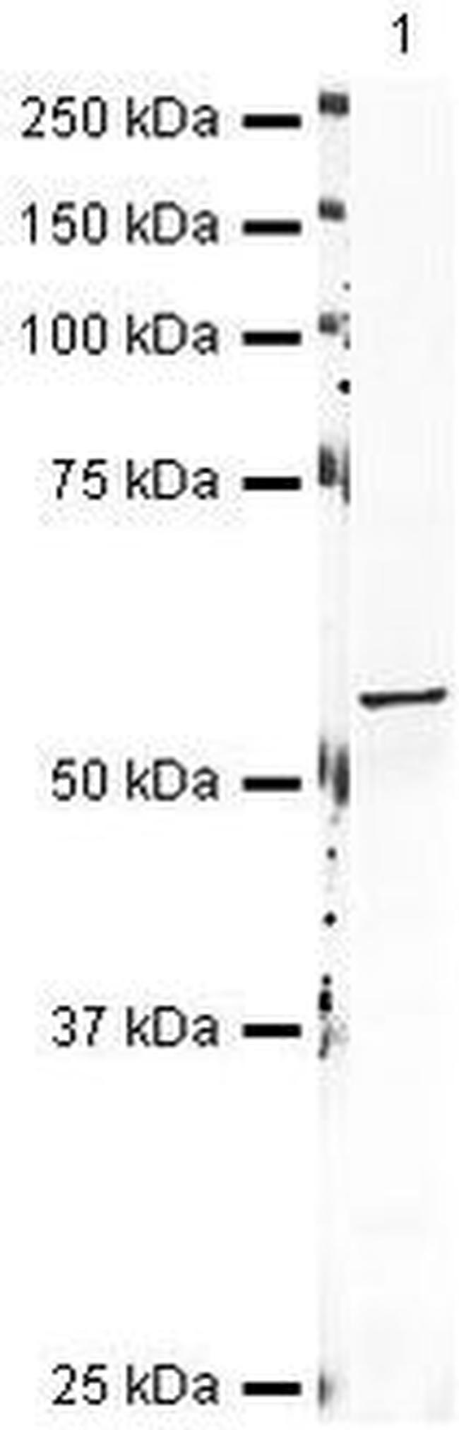 Aromatase Antibody in Western Blot (WB)