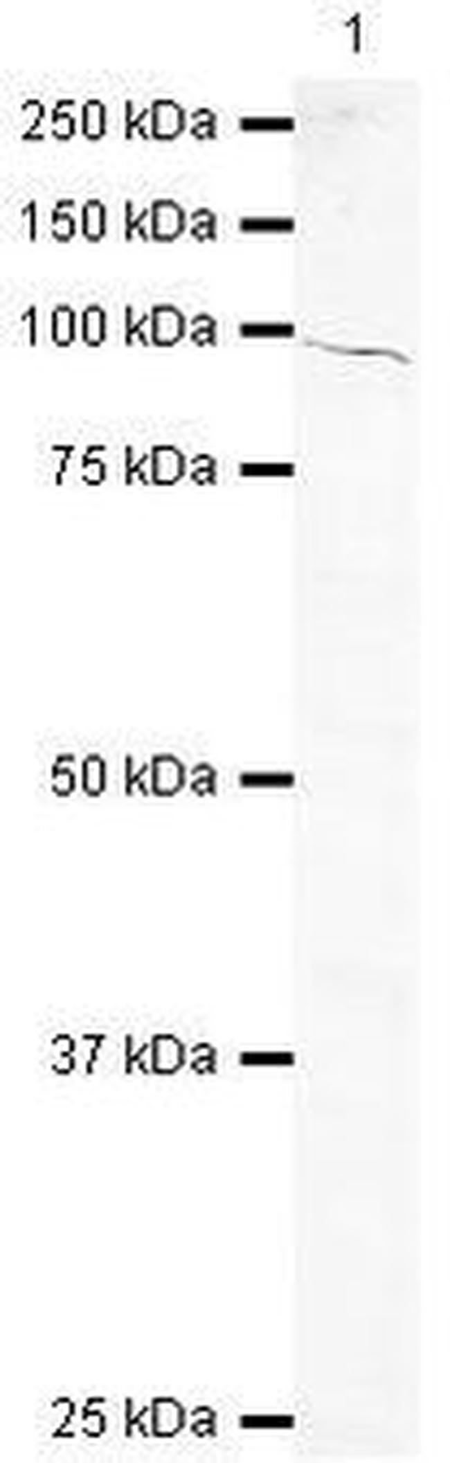 BAAT1 Antibody in Western Blot (WB)