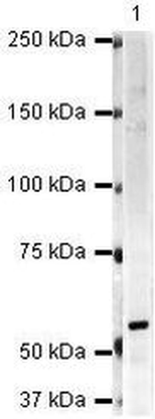 Artemis Antibody in Western Blot (WB)
