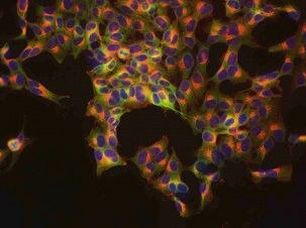RGS2 Antibody in Immunocytochemistry (ICC/IF)
