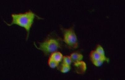 beta-2 Adrenergic Receptor Antibody in Immunocytochemistry (ICC/IF)
