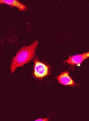 KIF11 Antibody in Immunocytochemistry (ICC/IF)