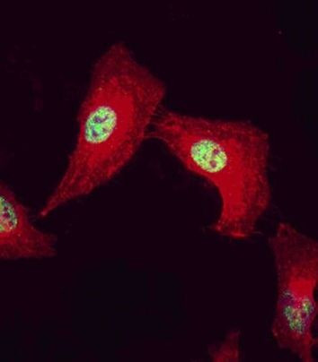 CDK9 Antibody in Immunocytochemistry (ICC/IF)