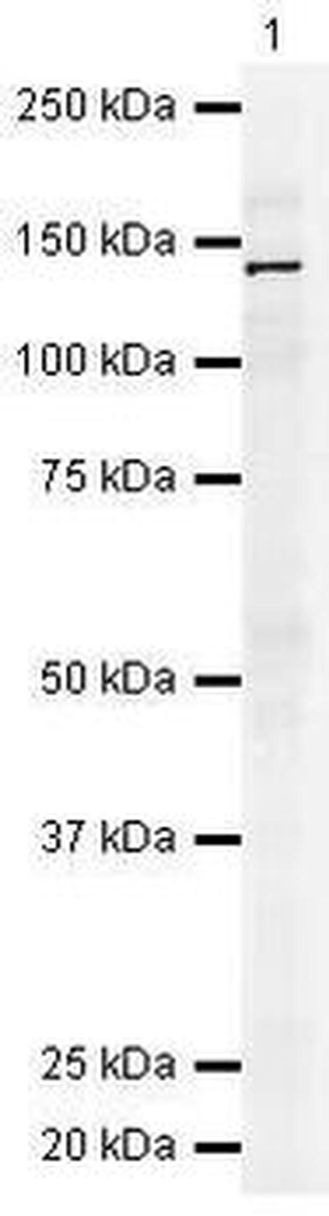 c-Met Antibody in Western Blot (WB)