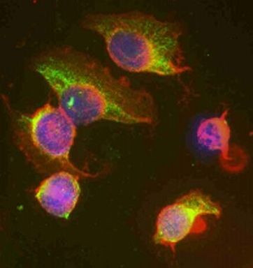 UBE2J1 Antibody in Immunocytochemistry (ICC/IF)
