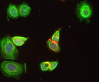 eIF4G3 Antibody in Immunocytochemistry (ICC/IF)