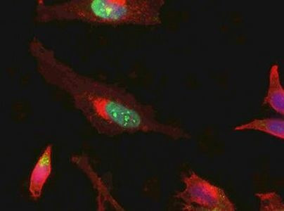 RSK3 Antibody in Immunocytochemistry (ICC/IF)