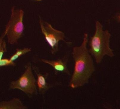 TRBP Antibody in Immunocytochemistry (ICC/IF)