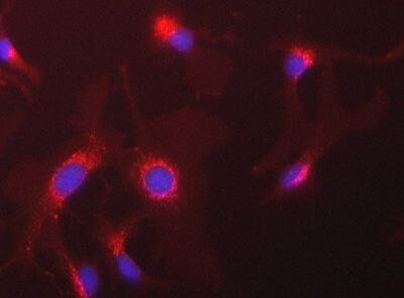 NCBP1 Antibody in Immunocytochemistry (ICC/IF)