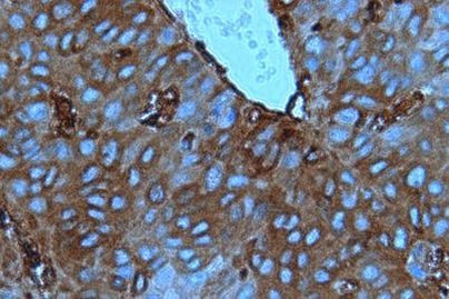 Cofilin Antibody in Immunohistochemistry (IHC)