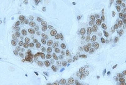 YY1 Antibody in Immunohistochemistry (IHC)