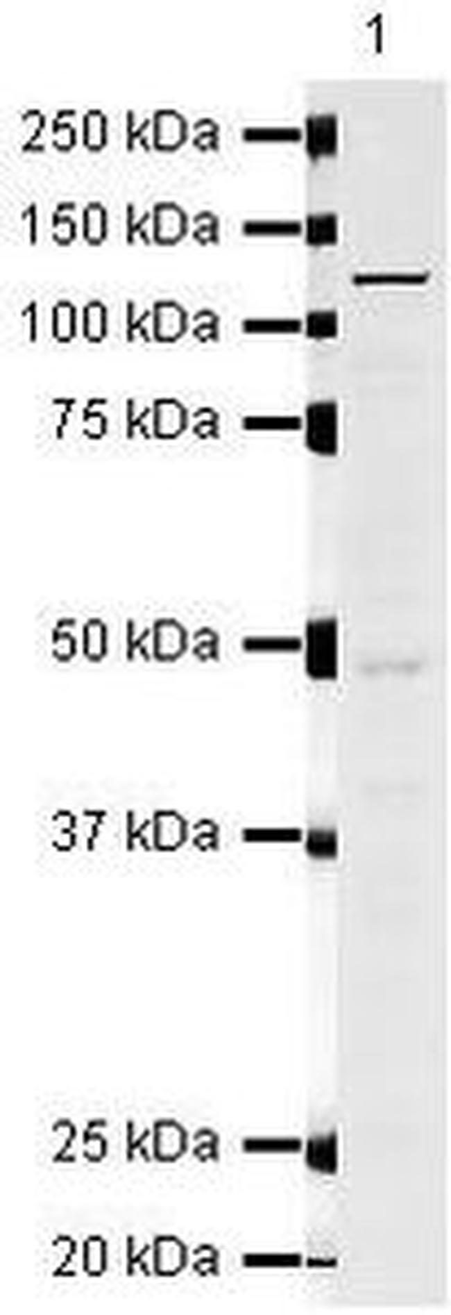 CDCA2 Antibody in Western Blot (WB)