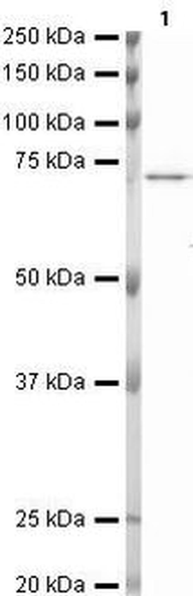 Lamin B Receptor Antibody in Western Blot (WB)
