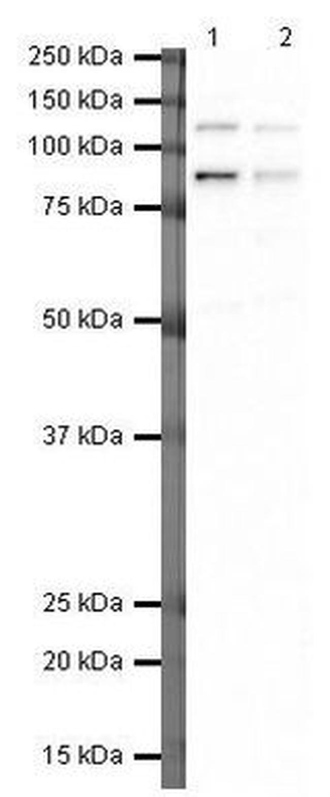 XPD Antibody in Western Blot (WB)