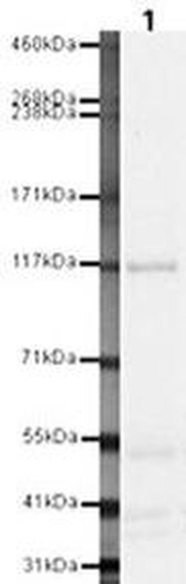 RET Antibody in Western Blot (WB)