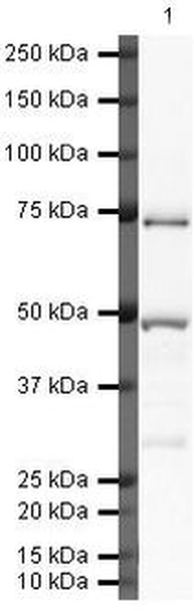 Complement C9 Antibody in Western Blot (WB)