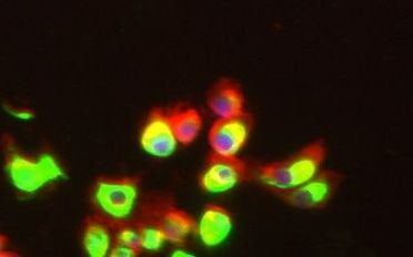 NEFM Antibody in Immunocytochemistry (ICC/IF)