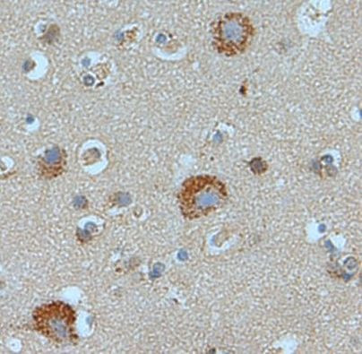 STAMBP Antibody in Immunohistochemistry (IHC)