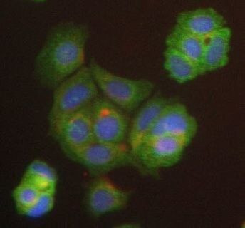 DDX58 Antibody in Immunocytochemistry (ICC/IF)