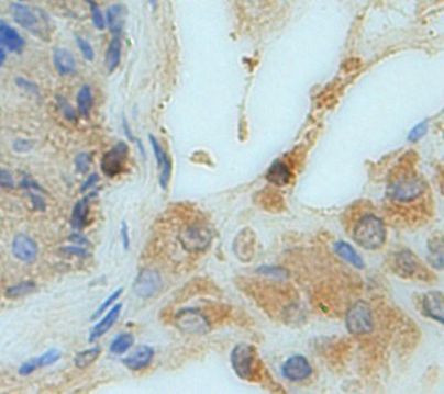 GC Antibody in Immunohistochemistry (Paraffin) (IHC (P))