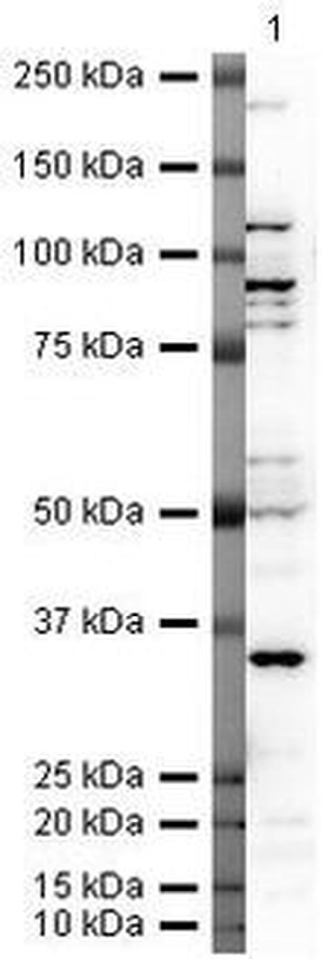 LOX-1 Antibody in Western Blot (WB)