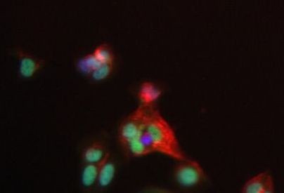 MAFB Antibody in Immunocytochemistry (ICC/IF)