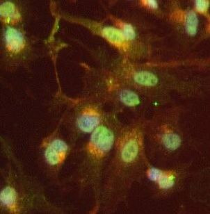 HOXA6 Antibody in Immunocytochemistry (ICC/IF)