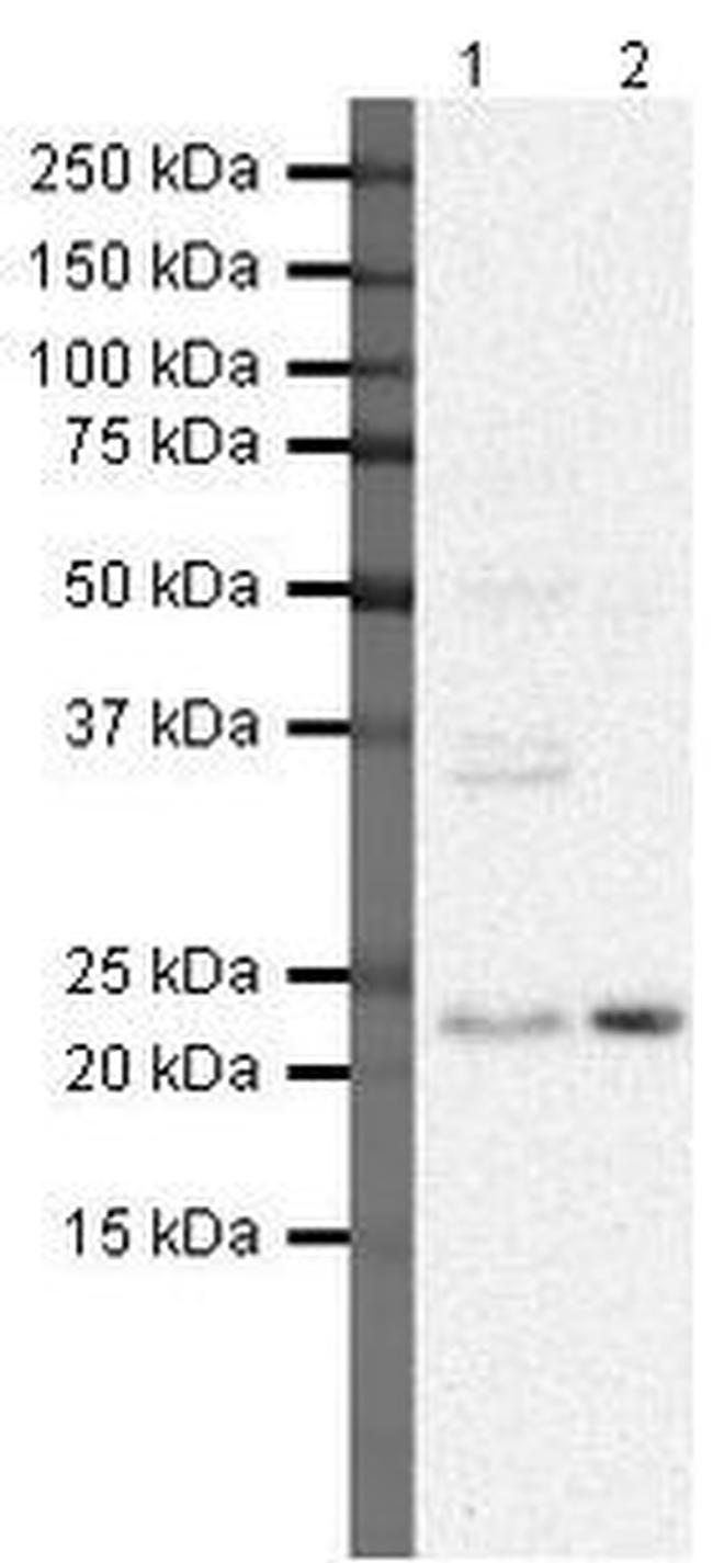 SOCS2 Antibody in Western Blot (WB)