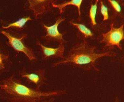 CHD2 Antibody in Immunocytochemistry (ICC/IF)