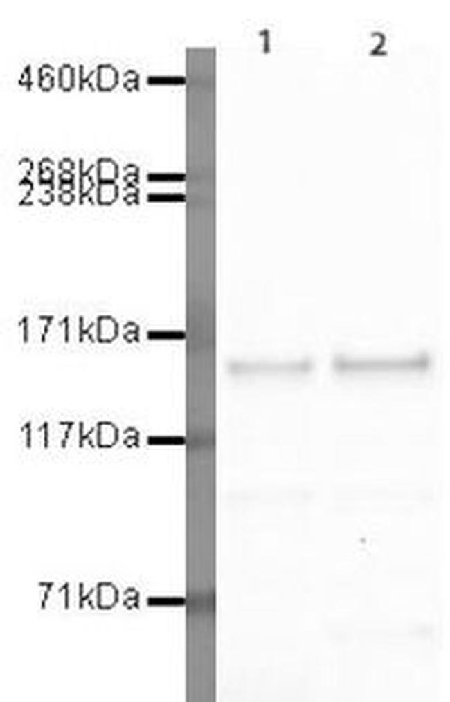 GLI3 Antibody in Western Blot (WB)