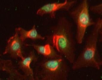 BRD1 Antibody in Immunocytochemistry (ICC/IF)