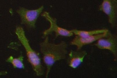 Nrf2 Antibody in Immunocytochemistry (ICC/IF)