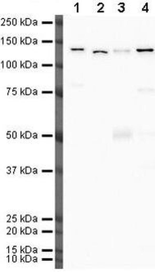 Vinculin Antibody in Western Blot (WB)