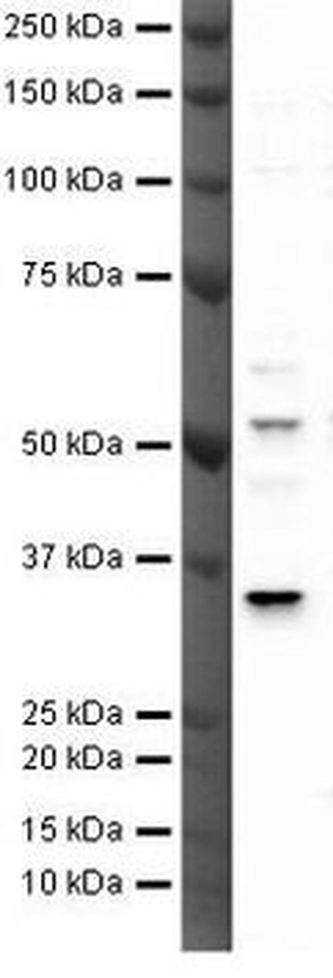 TREX2 Antibody in Western Blot (WB)