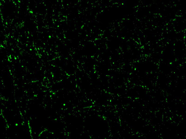 CIDEA Antibody in Immunocytochemistry (ICC/IF)