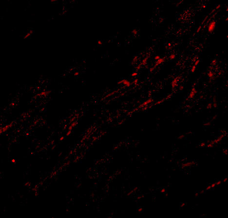 CIDEA Antibody in Immunocytochemistry (ICC/IF)