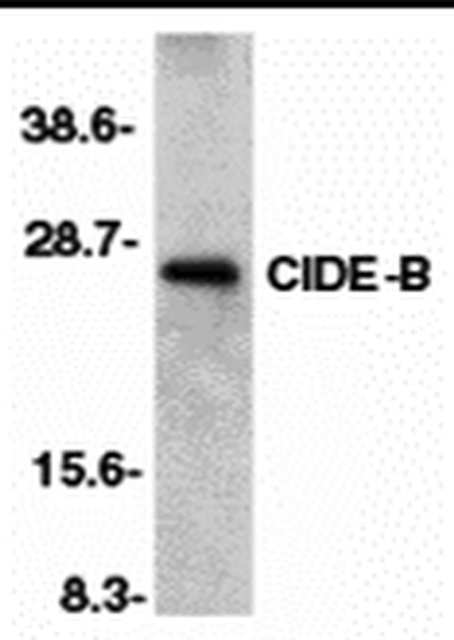 CIDEB Antibody in Western Blot (WB)