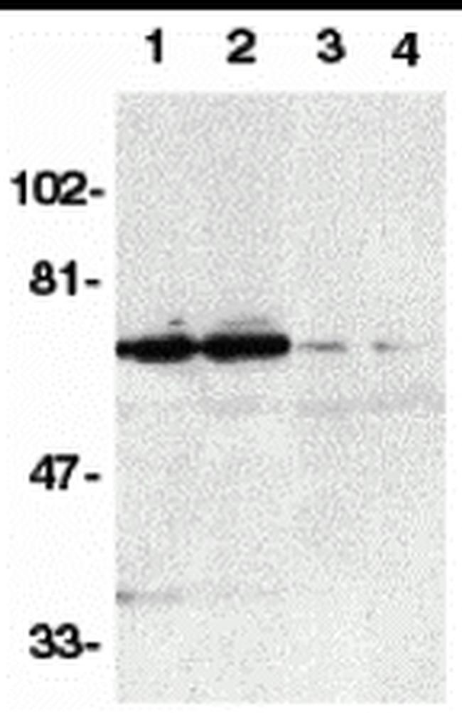 DR6 Antibody in Western Blot (WB)