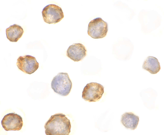 RIP2 Antibody in Immunocytochemistry (ICC/IF)