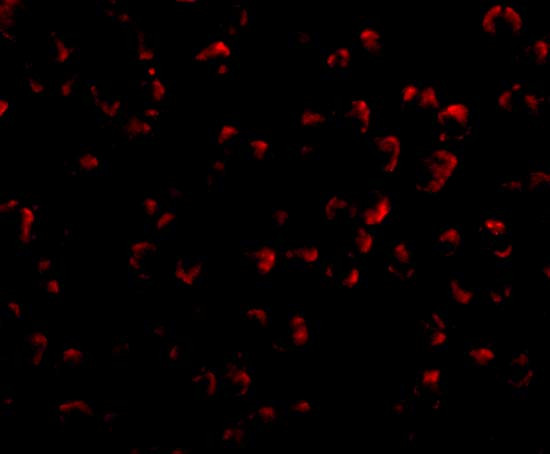 RYBP Antibody in Immunocytochemistry (ICC/IF)