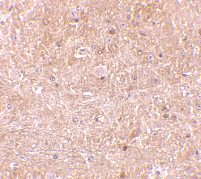 Caspase 13 Antibody in Immunohistochemistry (IHC)