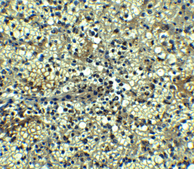 BCMA Antibody in Immunohistochemistry (Paraffin) (IHC (P))
