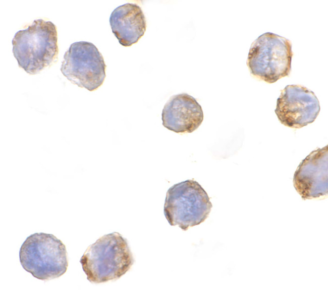 MTBP Antibody in Immunocytochemistry (ICC/IF)