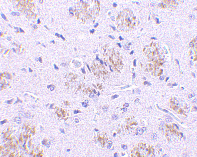 KLHL1 Antibody in Immunohistochemistry (IHC)