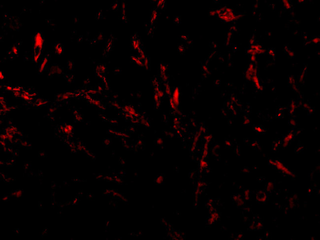 TTC5 Antibody in Immunocytochemistry (ICC/IF)
