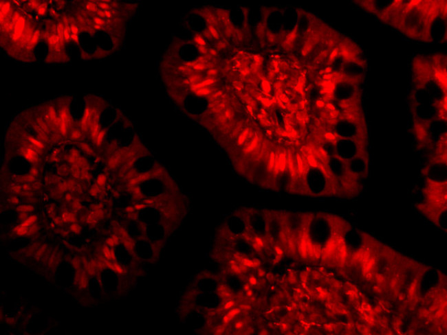 PHAP III Antibody in Immunocytochemistry (ICC/IF)