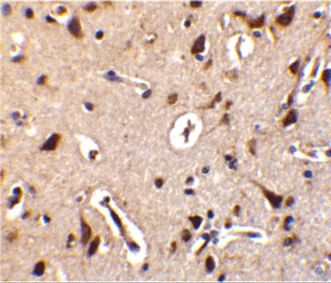 ALS2CR2 Antibody in Immunohistochemistry (IHC)