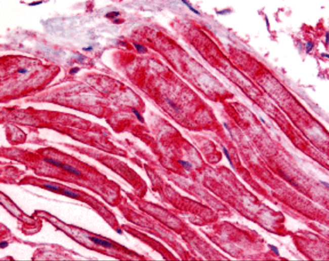 ALS2CR2 Antibody in Immunohistochemistry (IHC)