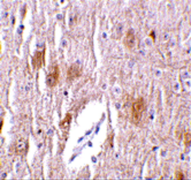 TRIM5 delta Antibody in Immunohistochemistry (IHC)